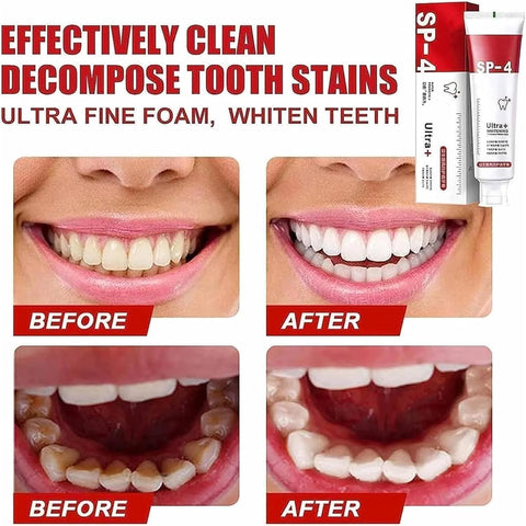 Yayashi Sp-4 Ultra Whitening Toothpaste Probiotic Stain Remover Stain Removing Toothpaste, Protects Gums Freshens Breath, for Everyone - 120 gram