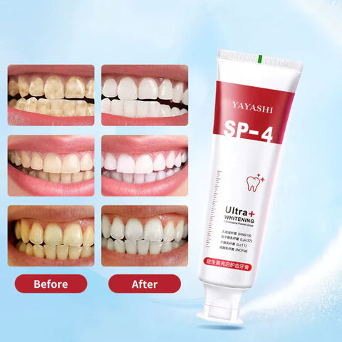 Yayashi Sp-4 Ultra Whitening Toothpaste Probiotic Stain Remover Stain Removing Toothpaste, Protects Gums Freshens Breath, for Everyone - 120 gram